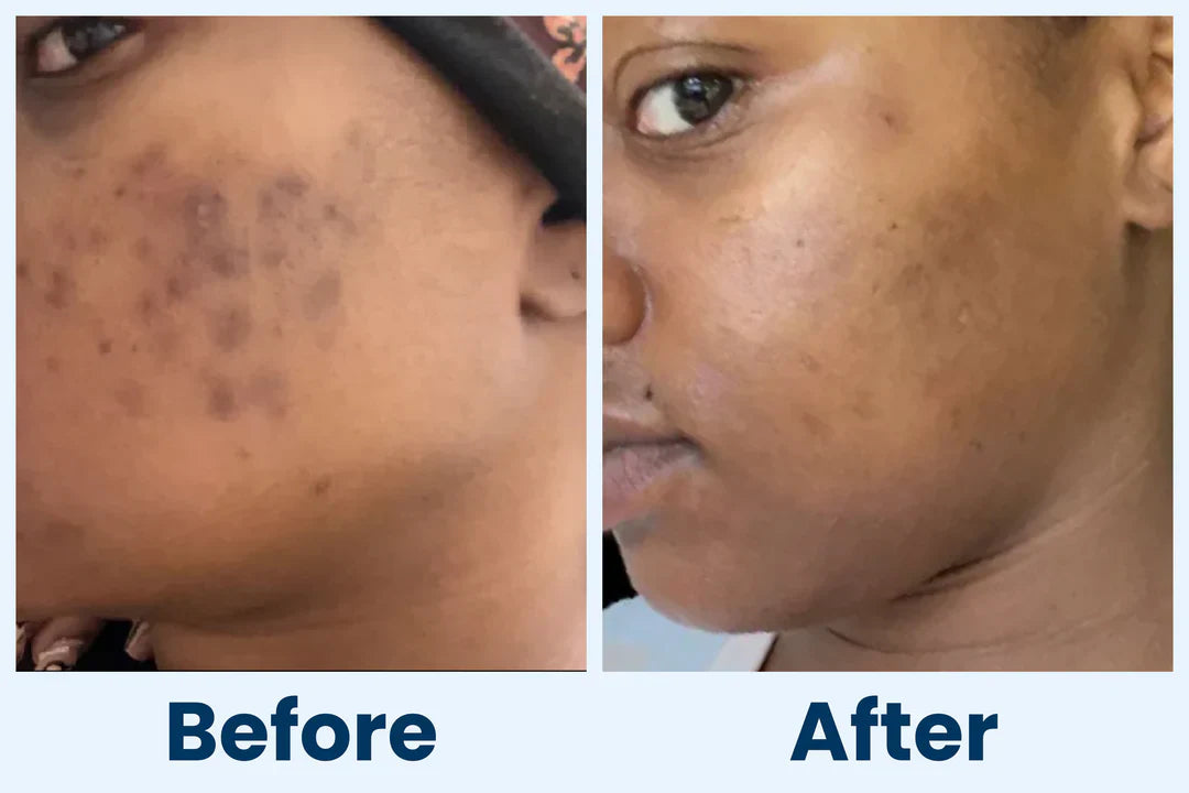 Clean Skin Club Canada 