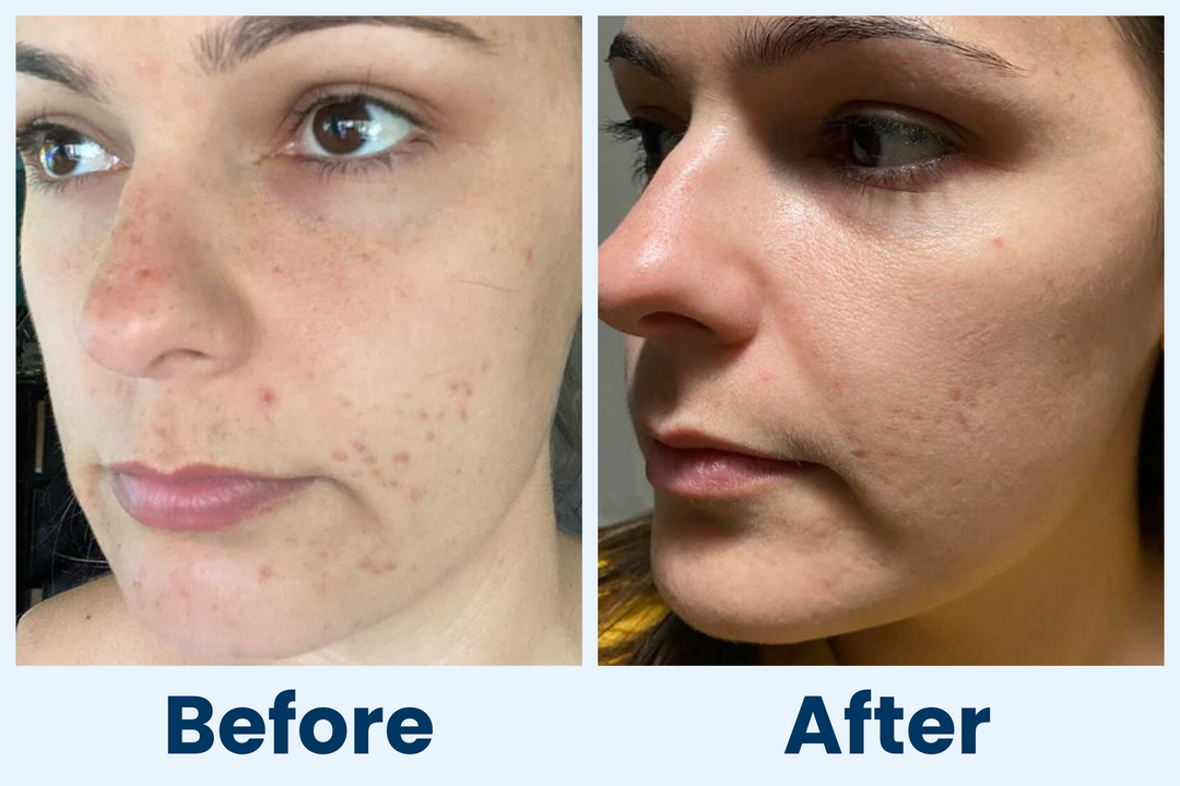 Clean Skin Club Canada 