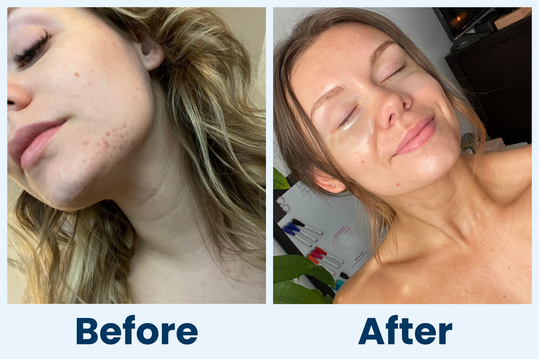 Clean Skin Club Canada 