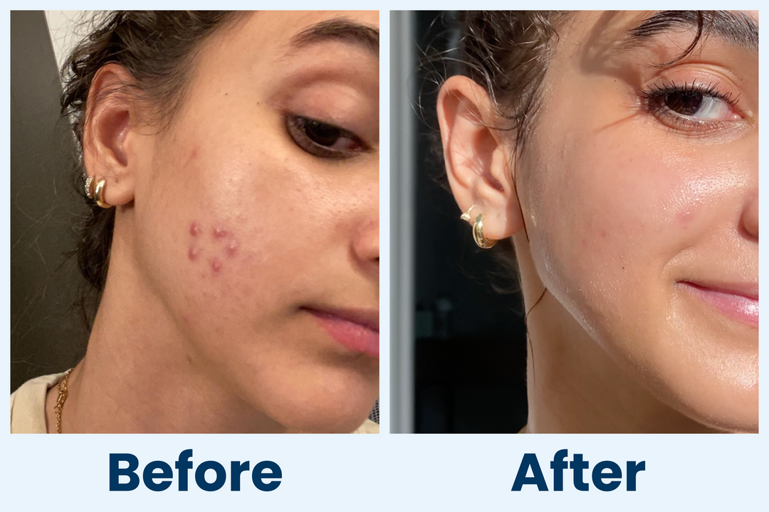 Clean Skin Club Canada 