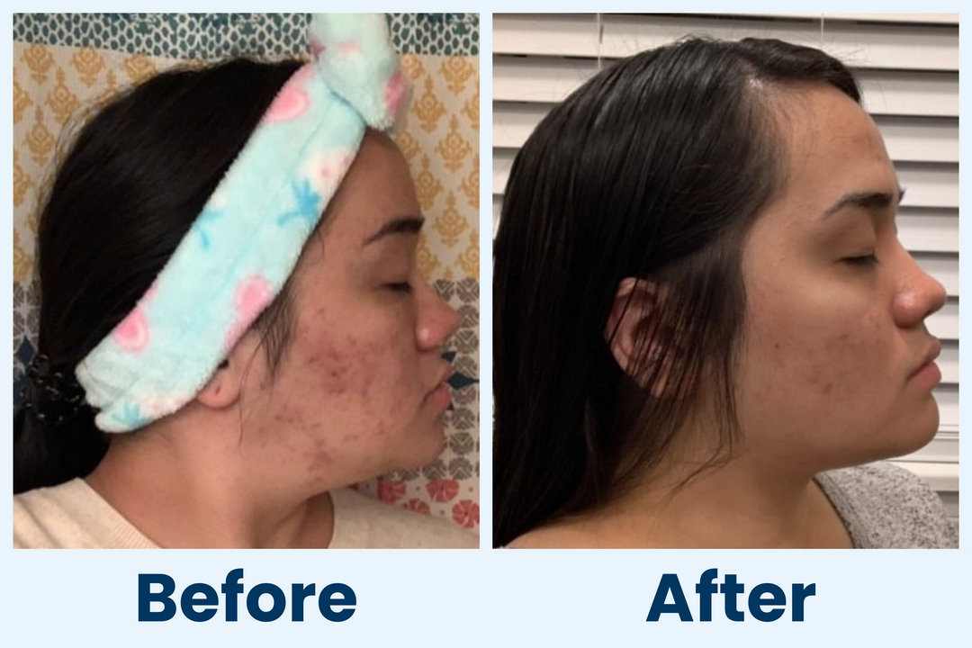 Clean Skin Club Canada 