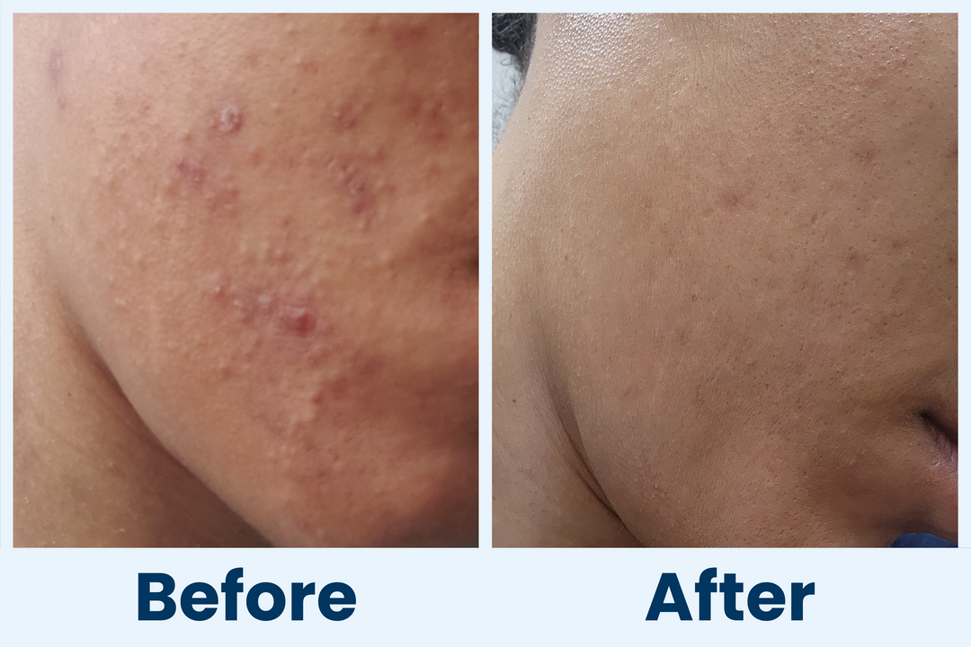 Clean Skin Club Canada 