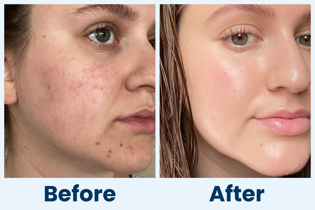 Clean Skin Club Canada 