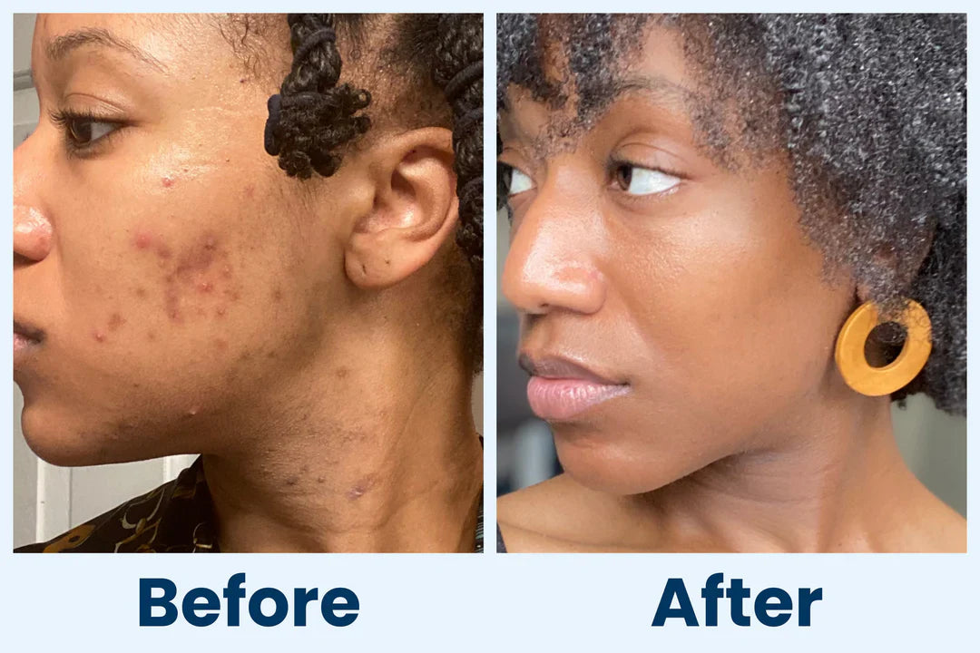 Clean Skin Club Canada 