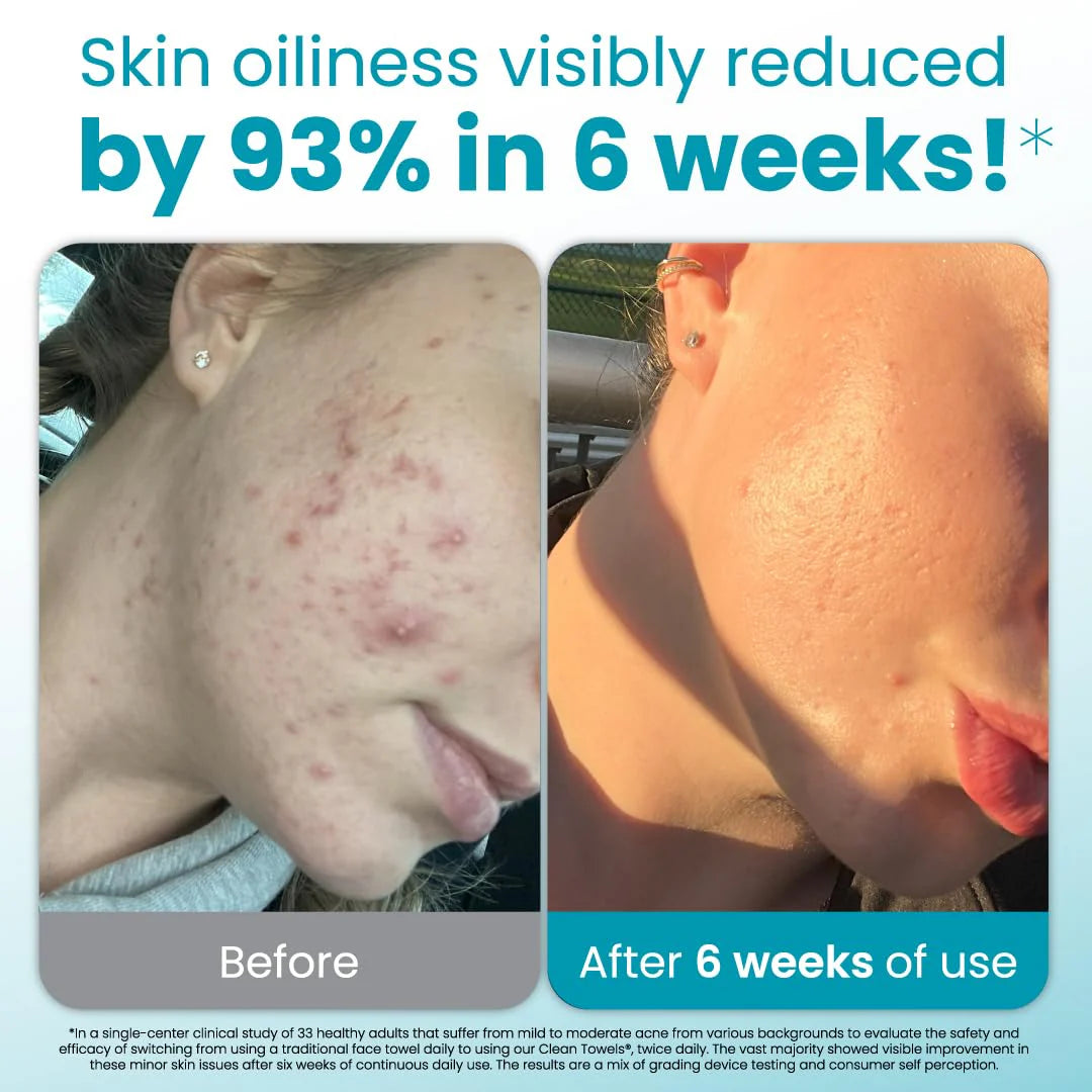 Clean Towels® Oily Skin