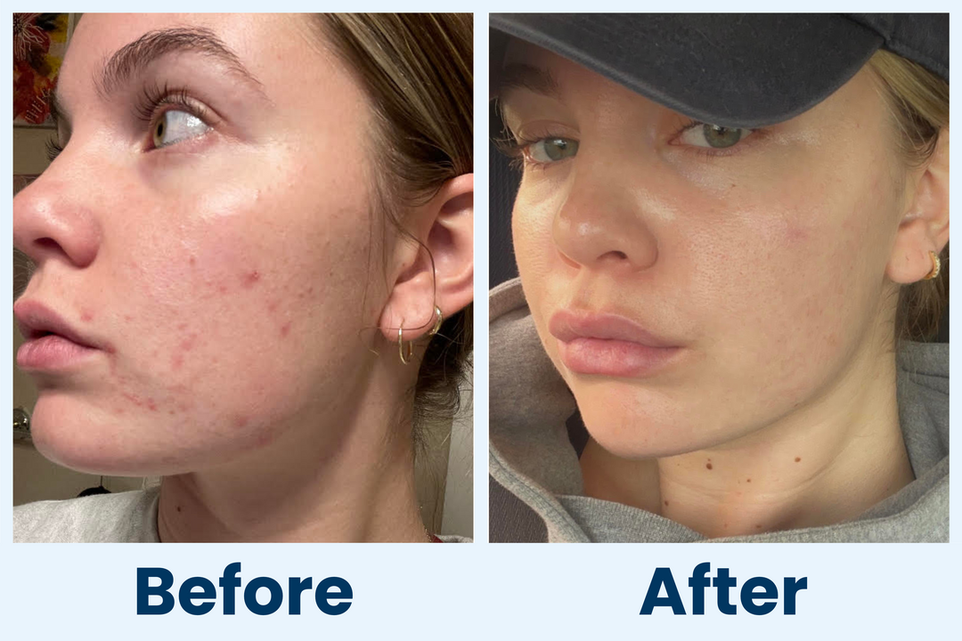 Clean Skin Club Canada 