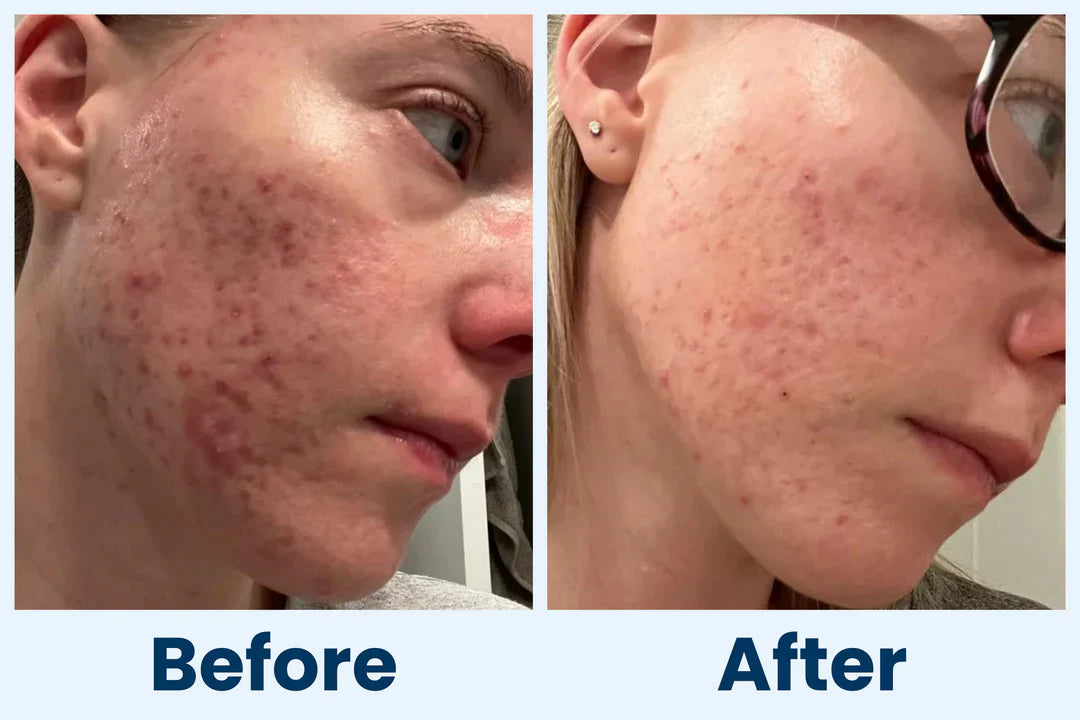 Clean Skin Club Canada 