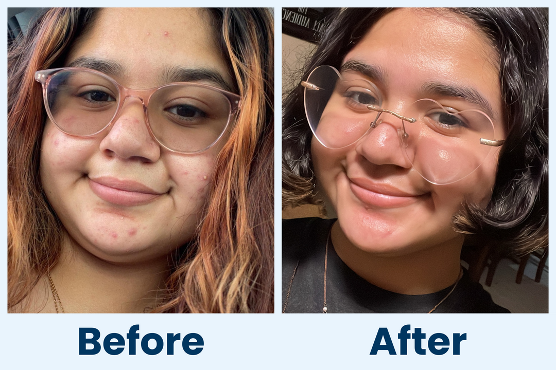 Clean Skin Club Canada 