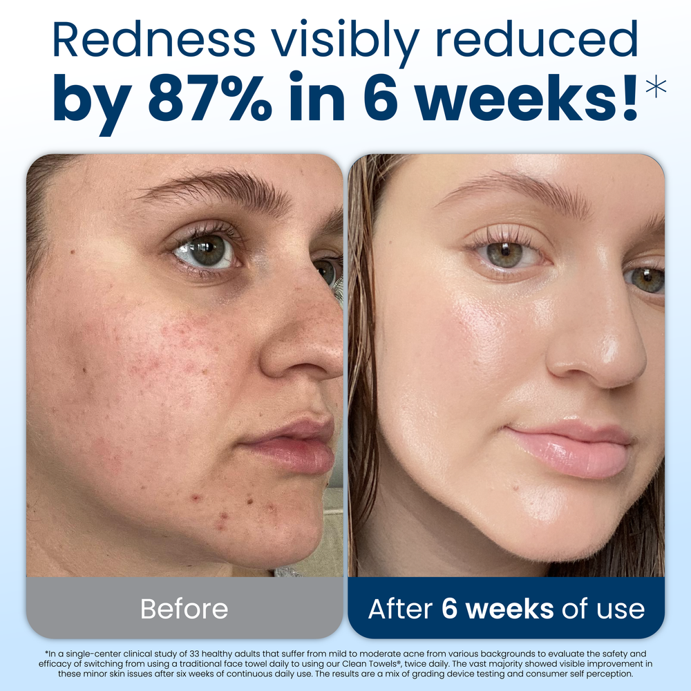 Clean Skin Club Canada 