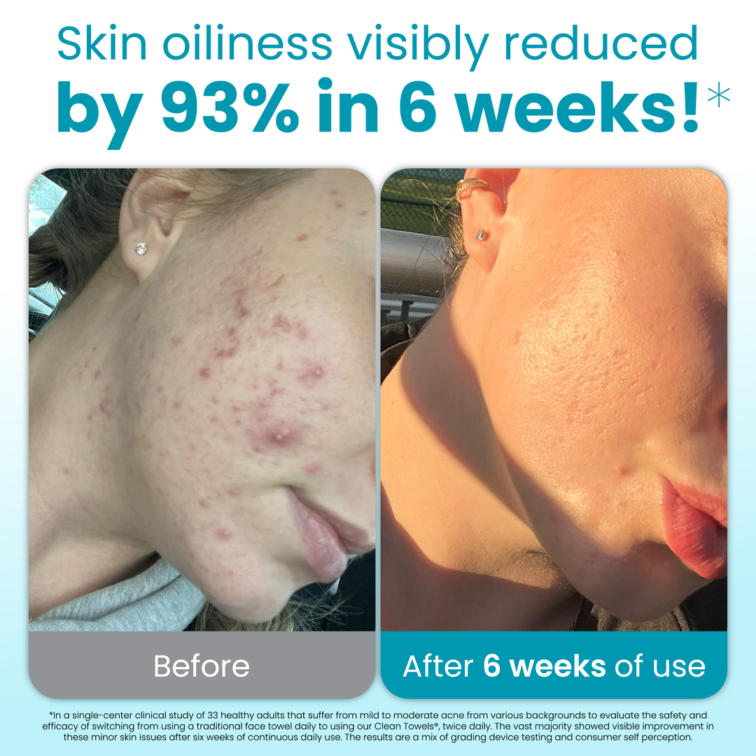 Clean Towels® Oily Skin