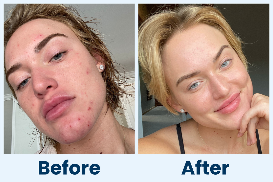 Clean Skin Club Canada 