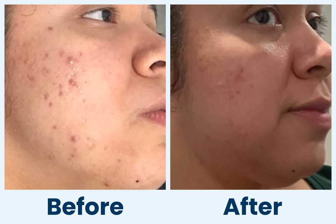 Clean Skin Club Canada 