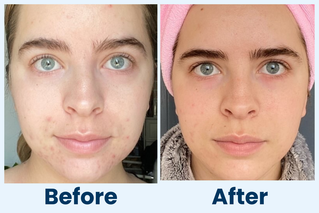 Clean Skin Club Canada 