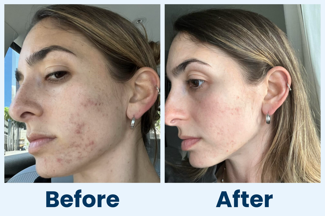 Clean Skin Club Canada 