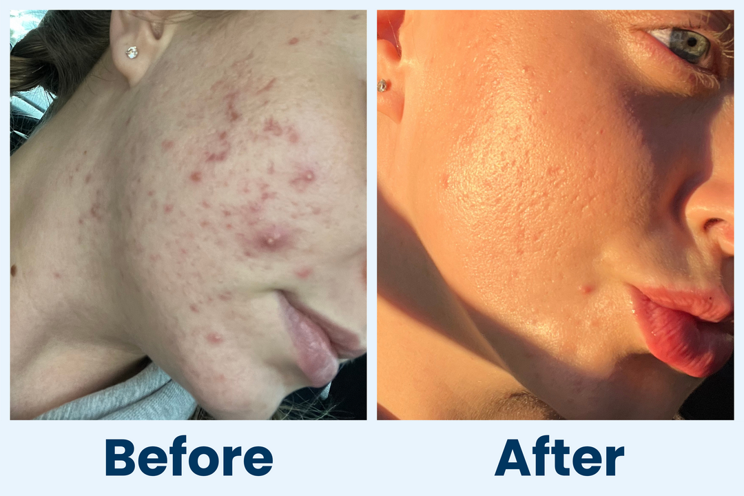 Clean Skin Club Canada 