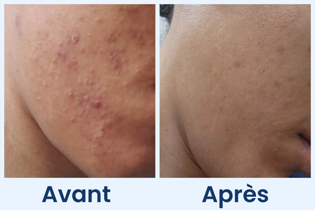 Clean Skin Club Canada 