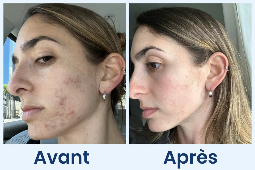 Clean Skin Club Canada 