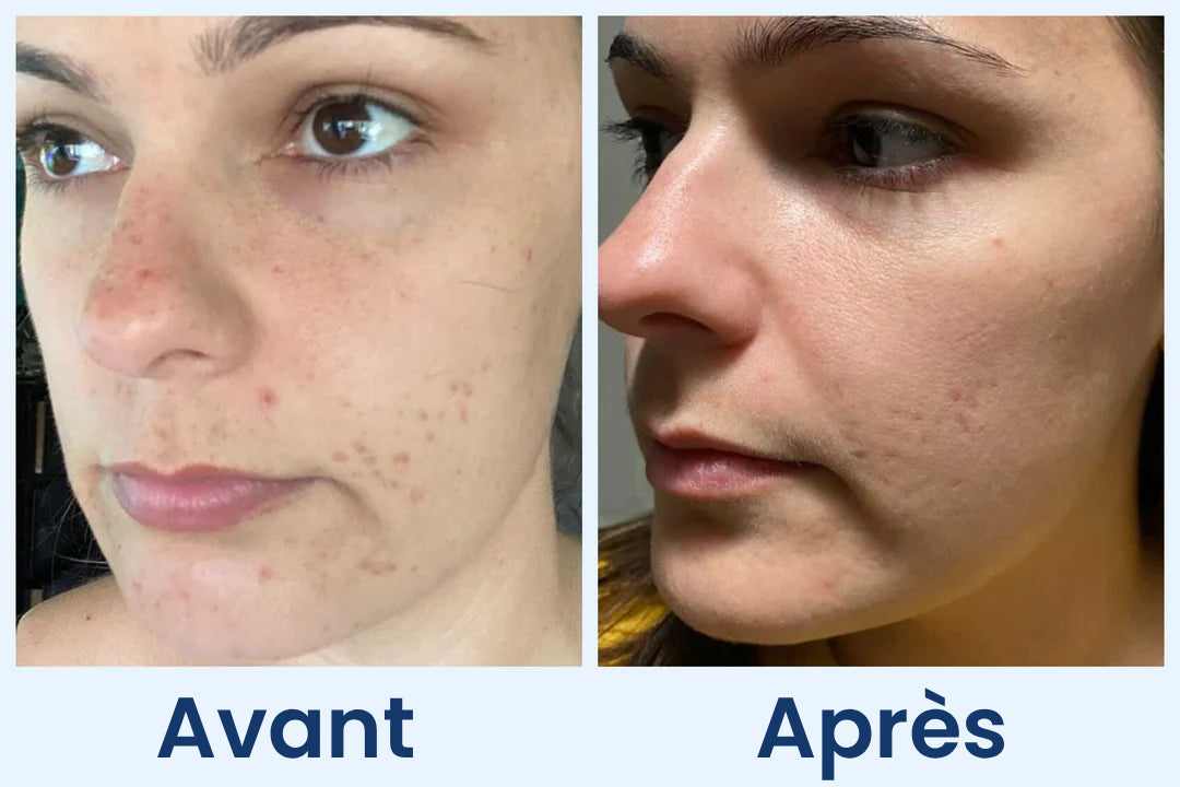 Clean Skin Club Canada 