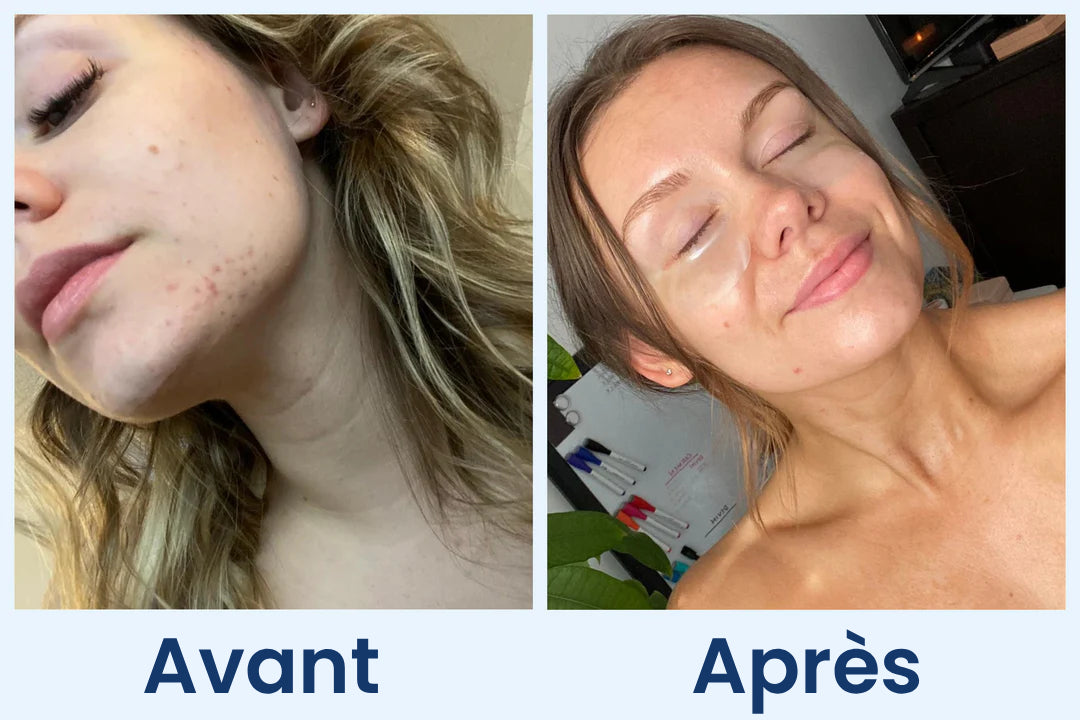Clean Skin Club Canada 
