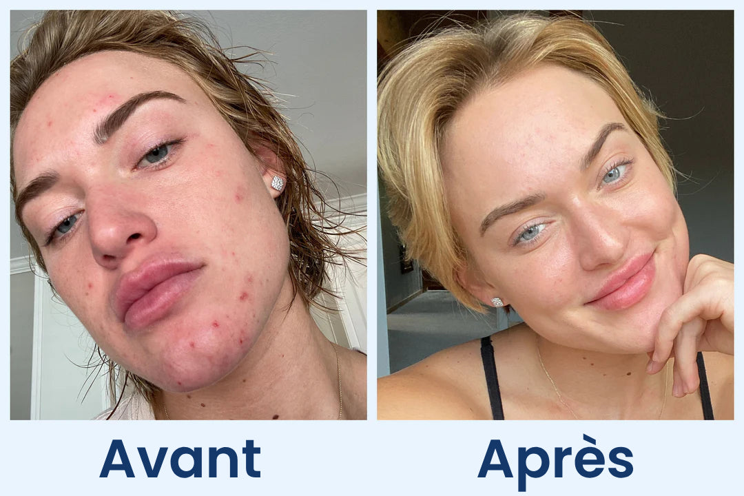 Clean Skin Club Canada 