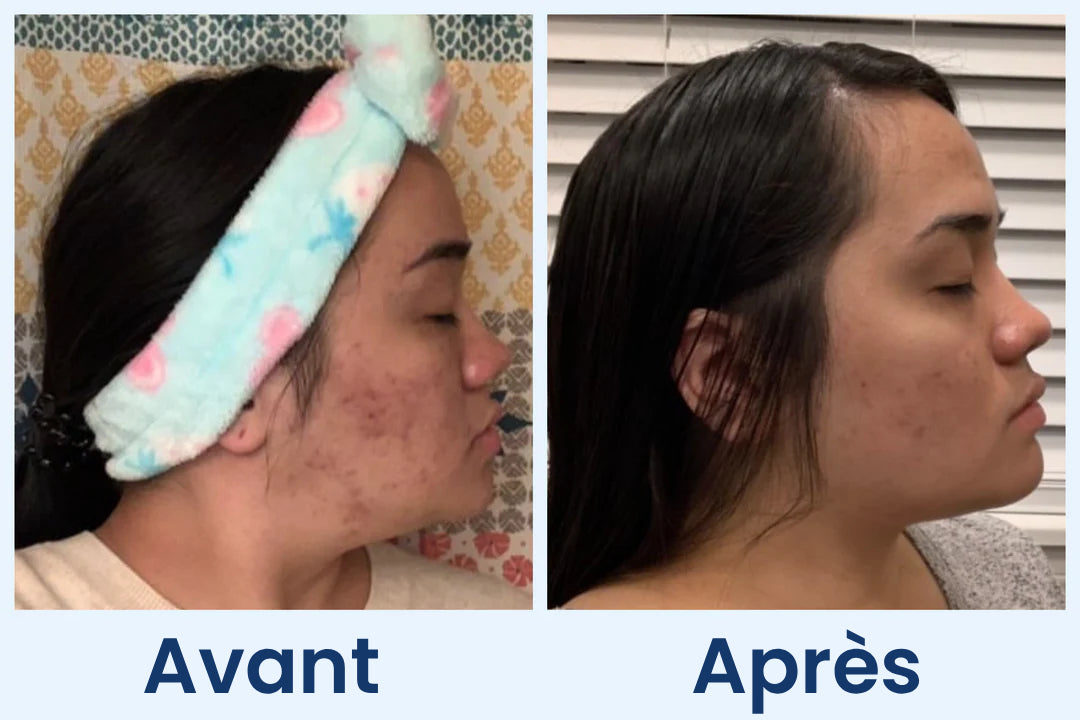 Clean Skin Club Canada 