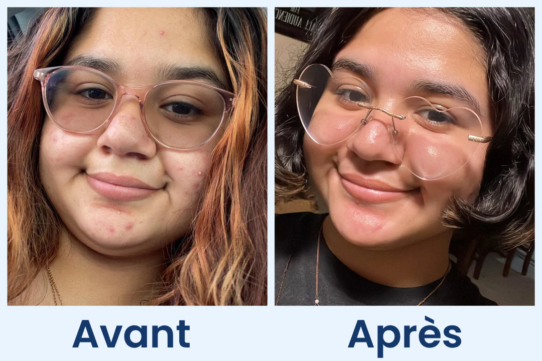 Clean Skin Club Canada 