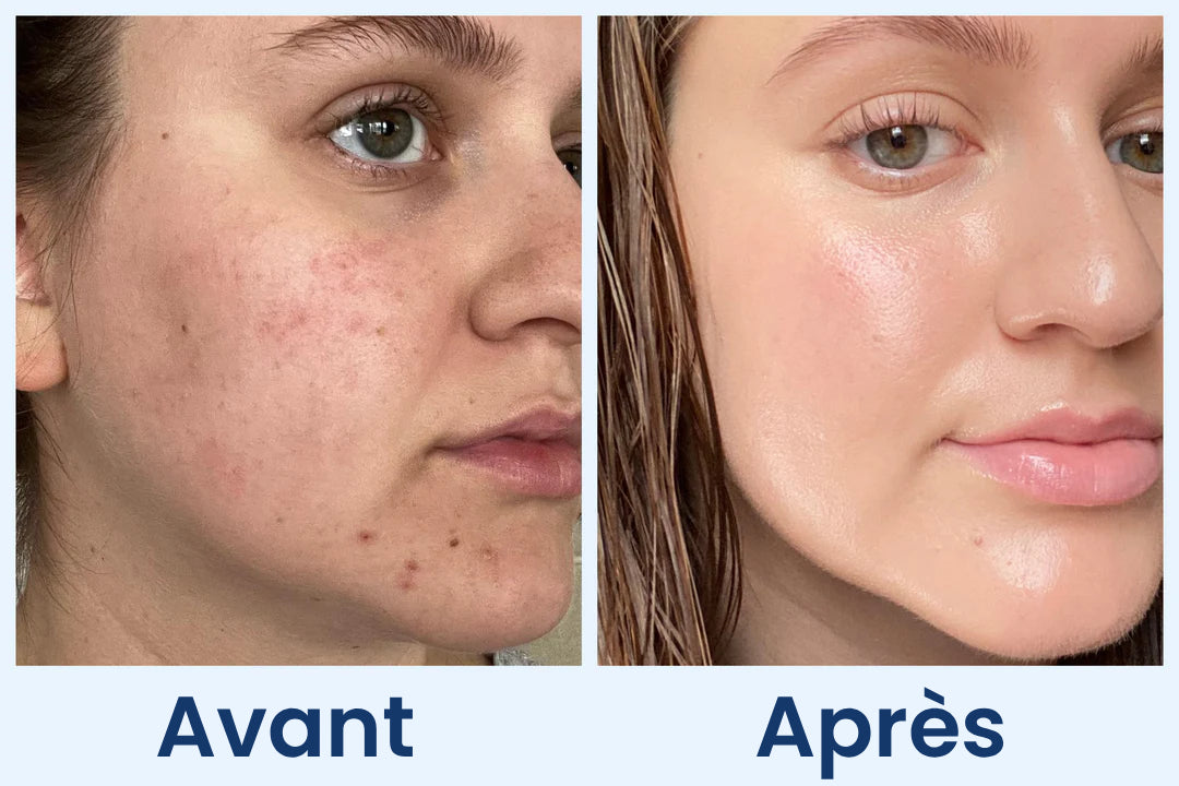 Clean Skin Club Canada 