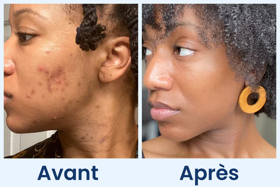 Clean Skin Club Canada 