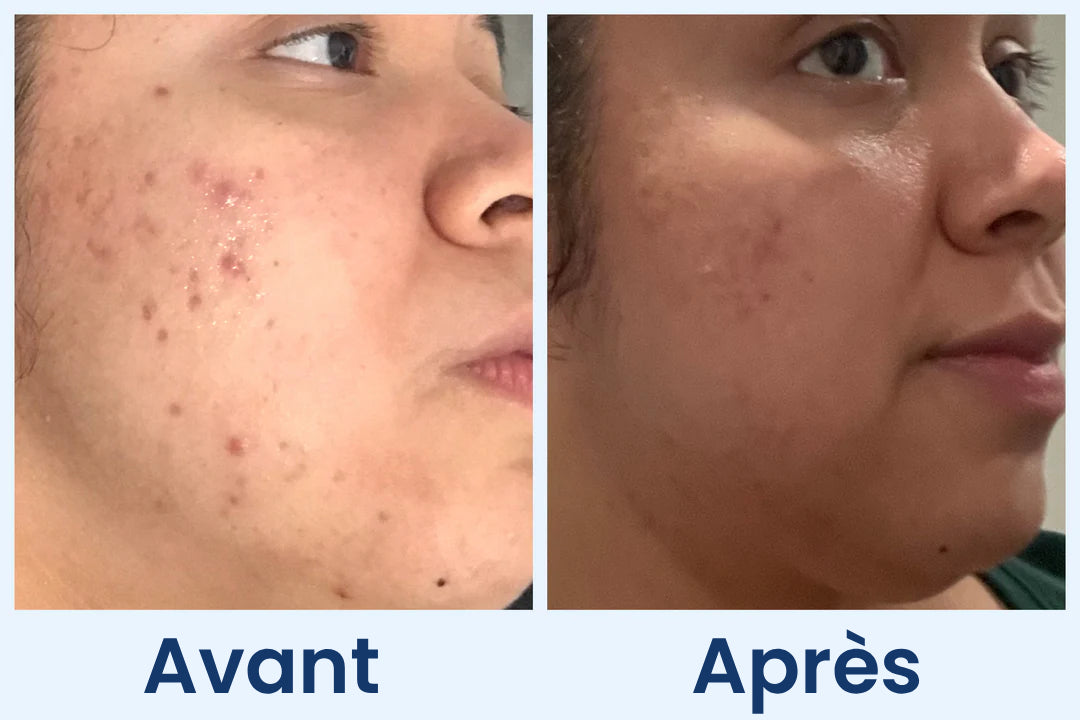 Clean Skin Club Canada 