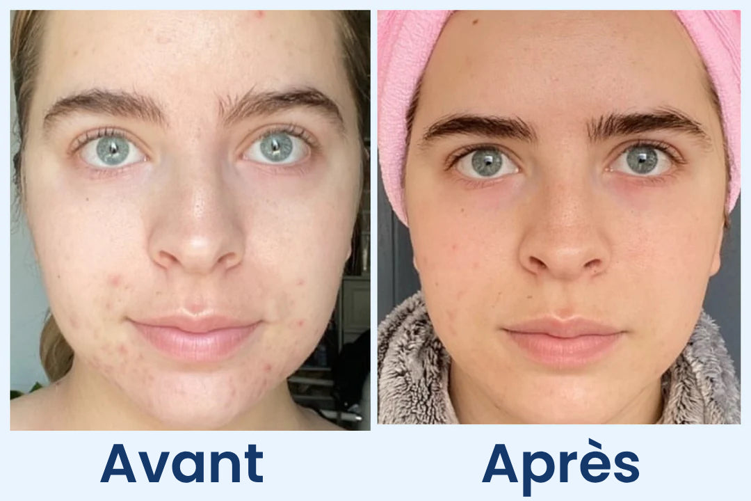 Clean Skin Club Canada 