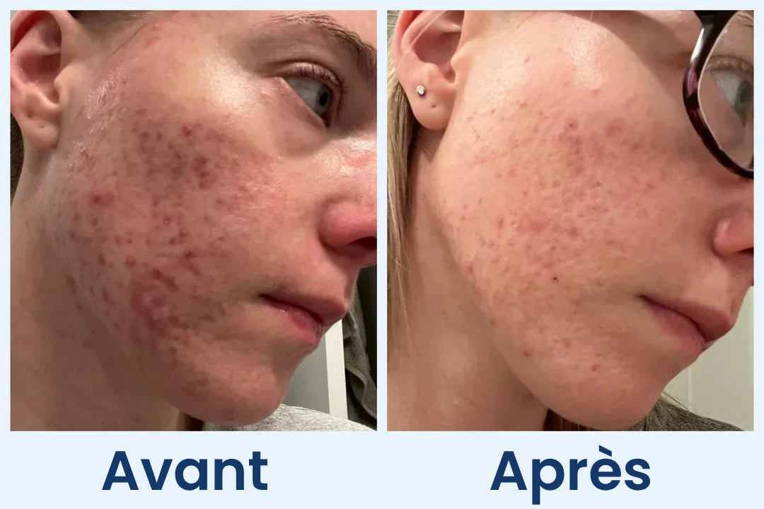 Clean Skin Club Canada 