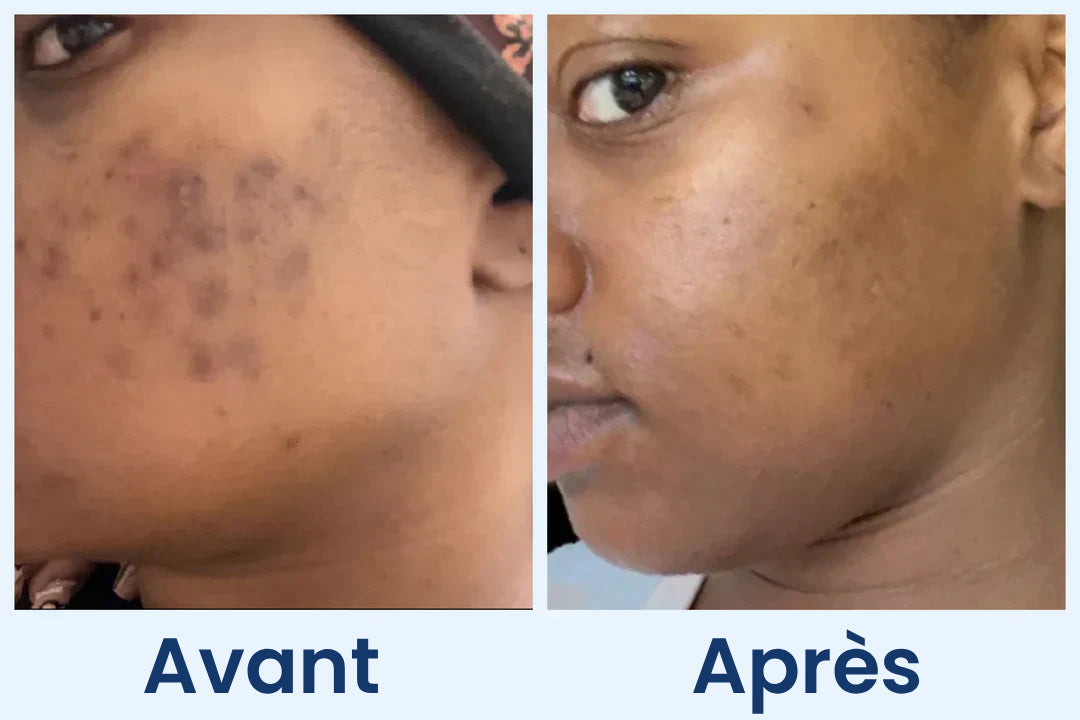 Clean Skin Club Canada 