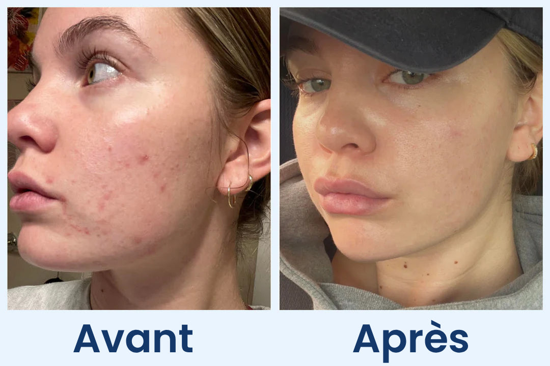 Clean Skin Club Canada 